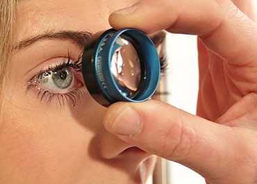 Glaucoma